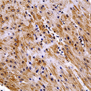 Rabbit Polyclonal Antibody to Catalase, Cat# RPCA-Catalase