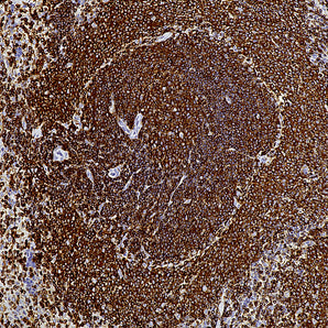Rabbit Polyclonal Antibody to Coronin 1a, Cat# RPCA-Cor1a