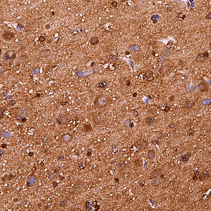 Rabbit Polyclonal Antibody to Parkinsonism Associated Deglycase (DJ1/Park7), Cat# RPCA-DJ1