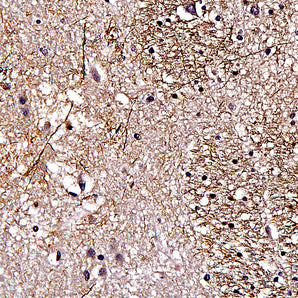 Rabbit Polyclonal Antibody to Neurofilament NF-L (Nfl, NEFL)  DegenoTag&trade; Peptide, Cat# RPCA-NF-L-Degen