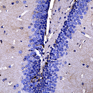 Rabbit Polyclonal Antibody to Fatty Acid Binding Protein 7 (FABP7), Cat# RPCA-FABP7