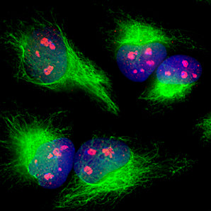 Rabbit Polyclonal Antibody to Fibrillarin Cat# RPCA-Fib