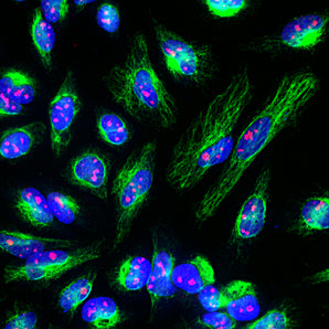 Rabbit Polyclonal Antibody to Fibrillarin Cat# RPCA-Fib