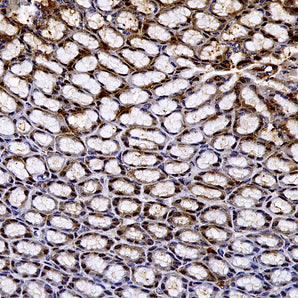 Rabbit Polyclonal Antibody to Galectin-3, Cat# RPCA-Gal3