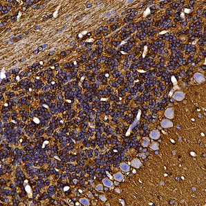 Rabbit Polyclonal Antibody to Growth Associated Protein 43 (GAP43), Cat# RPCA-GAP43