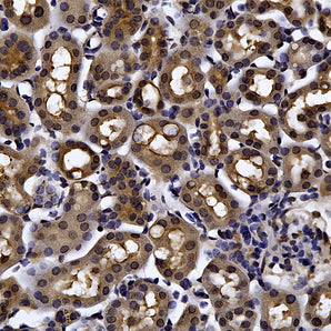 Rabbit Polyclonal Antibody to Glyceraldehyde-3-Phosphate Dehydrogenase(GAPDH), Cat# RPCA-GAPDH