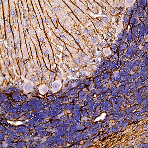 Rabbit Polyclonal Antibody to Glial Fibrillary Acidic Protein (GFAP), Cat# RPCA-GFAP