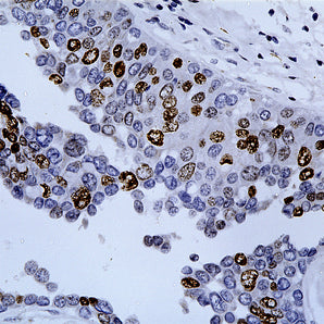 Rabbit Polyclonal Antibody to Ki67 (Ki-67), Cat# RPCA-Ki67