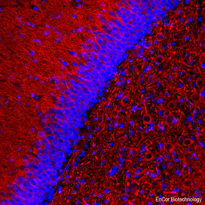 Rabbit Polyclonal Antibody to MAP2, RPCA-MAP2ABCD