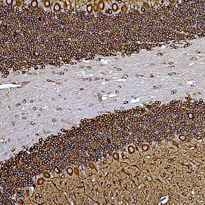 Rabbit Polyclonal Antibody to Microtubule Associated Protein MAP2ABCD (MAP2),  Cat# RPCA-MAP2ABCD