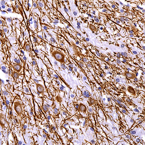 Rabbit Polyclonal Antibody to Microtubule Associated Protein MAP2D (MAP2), Cat#  RPCA-MAP2D