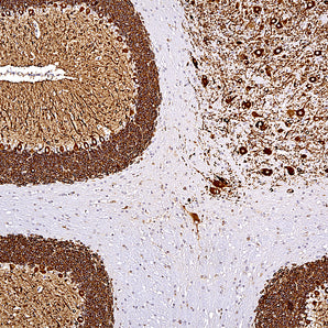 Rabbit Polyclonal Antibody to Microtubule Associated Protein MAP2AB (MAP2), Cat# RPCA-MAP2AB