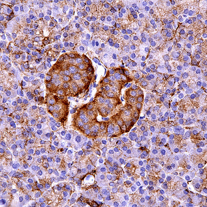 Rabbit Polyclonal Antibody to Myristoylated Alanine Rich Protein Kinase C Substrate (MARCKS), Cat# RPCA-MARCKS