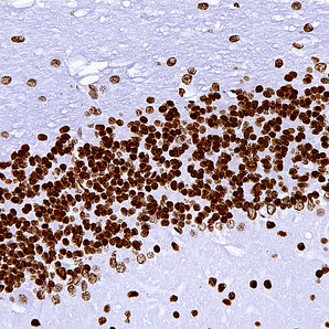 Rabbit Polyclonal Antibody to Methyl-CpG Binding Protein 2 (MeCP2),  Cat# RPCA-MeCP2