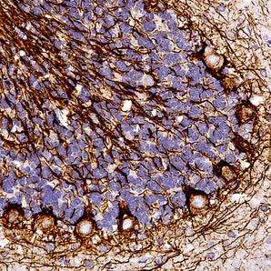 Rabbit Polyclonal Antibody to Neurofilament NF-H (Nfh, NEFH), Cat# RPCA-NF-H