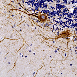 Rabbit Polyclonal Antibody to Neurofilament NF-L (Nfl, NEFL), Cat# RPCA-NF-L