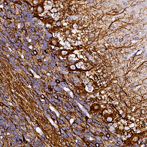 Rabbit Polyclonal Antibody to Neurofilament NF-L (Nfl, NEFL)  C-terminus, Cat# RPCA-NF-L-ct