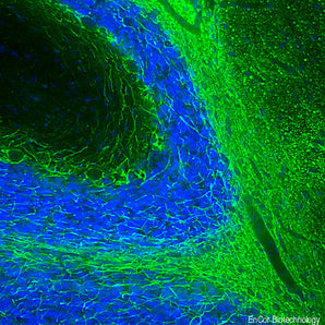 Rabbit Polyclonal Antibody to Neurofilament NF-M (Nfm, NEFM) Cat# RPCA-NF-M