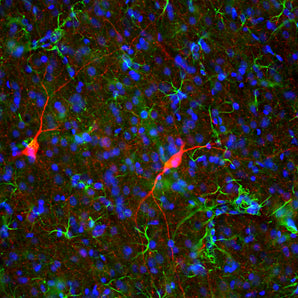 Rabbit Polyclonal Antibody to Nitric Oxide Synthase 1 (NOS1, neuronal NOS, nNOS) Cat# RPCA-NOS1