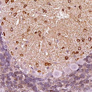 Rabbit Polyclonal Antibody to Nitric Oxide Synthase 1 (NOS1, neuronal NOS, nNOS) Cat# RPCA-NOS1