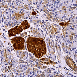 Rabbit Polyclonal Antibody to Neuron Specific Enolase (NSE, ENO2, &gamma;-enolase), Cat# RPCA-NSE