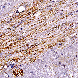 Rabbit Polyclonal Antibody to Peripherin, Cat# RPCA-Peri