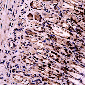 Rabbit Polyclonal Antibody to Ki67-Rodent (Ki-67), Cat#  RPCA-Ki67-Ro