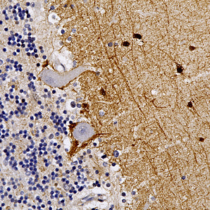 Rabbit Polyclonal Antibody to Secretagogin, Cat# RPCA-SCGN