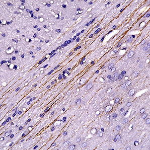 Rabbit Polyclonal Antibody to Serotonin Transporter (SERT), Cat# RPCA-SERT