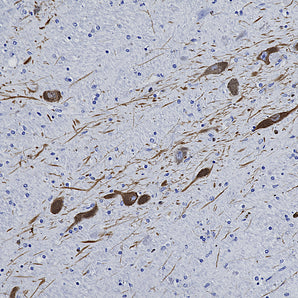 Rabbit Polyclonal Antibody to Tyrosine Hydroxylase RPCA-TH