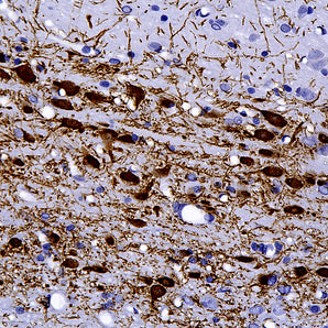 Rabbit Polyclonal Antibody to Tyrosine Hydroxylase (TH), Cat# RPCA-TH