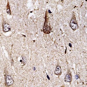 Rabbit Polyclonal Antibody to Ubiquitin, Cat# RPCA-Ubi