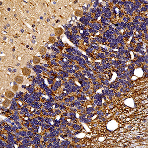 Rabbit Polyclonal Antibody to Ubiquitin C-Terminal Hydroxylase L1 (UCHL1), Cat# RPCA-UCHL1