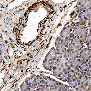 Rabbit Polyclonal Antibody to Vimentin, Cat# RPCA-Vim