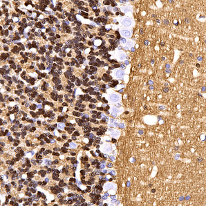 Rabbit Polyclonal Antibody to Visinin Like Protein 1 (VLP1), Cat# RPCA-VLP1