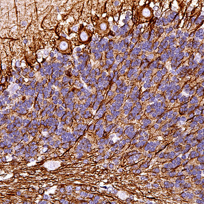 Rabbit Polyclonal Antibody to α-Internexin/NF66, Cat# RPCA-a-Int