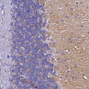 Rabbit Polyclonal Antibody to αII-Spectrin, Cat# RPCA-aII-Spec