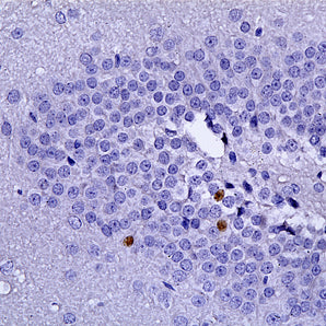 Rabbit Polyclonal Antibody to c-FOS (cFos, Fos, AP-1), Cat# RPCA-c-FOS