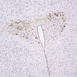 Rabbit Polyclonal Antibody to mCherry  Cat# RPCA-mCherry