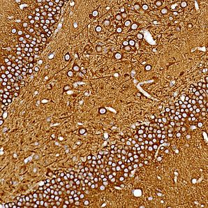 Mouse Monoclonal Antibody to Phospho-MAP-&tau;-Tp205 (phospho-MAPT T205), Cat# MCA-1H103