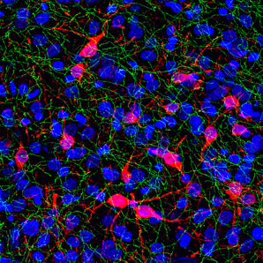 Rabbit Polyclonal Antibody to SERT RPCA-SERT