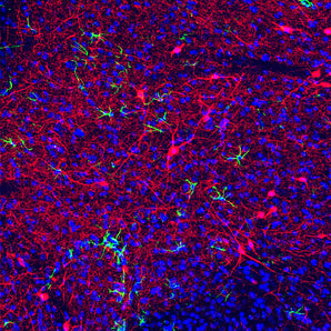 Rabbit Polyclonal Antibody to Nitric Oxide Synthase 1 (NOS1, neuronal NOS, nNOS) Cat# RPCA-NOS1
