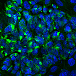 Immunofluorescent analysis of the widely used rat pheochromocytoma PC 12 cell line stained with rabbit polyclonal antibody to peripherin, RPCA-Peri, dilution 1:2,000, in green. The blue is Hoechst staining of nuclear DNA. Peripherin, one of the Class III family of intermediate filament subunit proteins, is a major component of the PC12 cell forming a perinuclear cap, with some filaments visible in the cytoplasm.