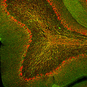 Immunofluorescent analysis of rat cerebellum section stained with chicken pAb to CNP, CPCA-CNP, dilution 1:2,000 in green and costained with rabbit pAb to NF-H, <a href="http://encorbio.com/products/rpca-nf-h/" target="_blank" rel="noopener">RPCA-NF-H</a>, dilution 1:10,000, in red. Following transcardial perfusion of rat with 4% paraformaldehyde, brain was post fixed for 24 hours, cut to 45μM, and free-floating sections were stained with above antibodies. The CNP antibody stains myelin and olig