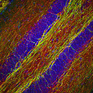 Immunohistological analysis of a mouse hippocampus section stained with rabbit pAb to NF-H, RPCA-NF-H, dilution 1:2,000 in red, and costained with mouse mAb to myelin basic protein (MBP), <a href="http://encorbio.com/products/mca-7g7" target="_blank" rel="noopener">MCA-7G7</a>, dilution 1:5,000 in green. The blue is DAPI staining of nuclear DNA. Following transcardial perfusion with 4% paraformaldehyde, brain was post fixed for 24 hours, cut to 45μM, and free-floating sections were stained with 