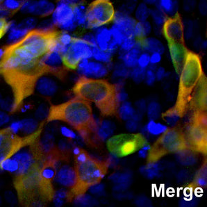 HEK293 cells were transfected with a fusion construct of green fluorescent protein (GFP) fused with the C-terminal sequence 803-1053 of <em>S. aureus</em> Cas9. Cells were stained with mouse mAb to <em>S. aureus</em>Cas9, MCA-6F7, in red and the expressed GFP gives a green signal. The two signals overlap as expected. The nuclei of both transfected and untransfected cells are revealed by the DAPI DNA stain.