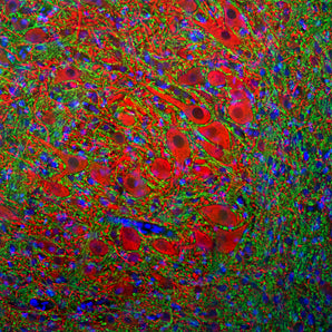 Immunofluorescent analysis of rat brain stem section stained with goat pAb to MAP2, GPCA-MAP2, dilution 1:2,000 in red, and costained with mouse mAb to MBP, <a href="http://encorbio.com/products/mca-7d2" target="_blank" rel="noopener">MCA-7D2</a>, dilution 1:5,000, in green. Following transcardial perfusion of rat with 4% paraformaldehyde, brain was post fixed for 24 hours, cut to 45μM, and free-floating sections were stained with above antibodies. The GPCA-MAP2 antibody labels MAP2 protein in t