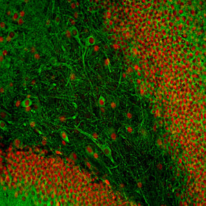 Immunofluorescent analysis of adult rat hippocampus section stained with mouse mAb to MAP2A/B/C/D, MCA-2C4, dilution 1:5,000 in green, and chicken pAb to FOX2, <a href="http://encorbio.com/products/CPCA-FOX2" target="_blank" rel="noopener">CPCA-FOX2</a>, dilution 1:2,000, in red. Following transcardial perfusion of rat with 4% paraformaldehyde, brain was post fixed for 24 hours, cut to 45μM, and free-floating sections were stained with above antibodies. MCA-2C4 antibody labels all MAP2 protein i