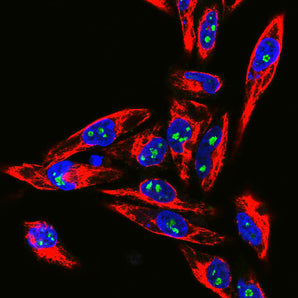 Confocal immunofluorescent analysis of HeLa cells stained with chicken pAb to fibrillarin, CPCA-fib, dilution 1:10,000 in green and costained with mouse mAb to vimentin, <a href="http://encorbio.com/products/mca-2d1/" target="_blank" rel="noopener">MCA-2D1</a>, 1:1,000, in red. The blue signal is DAPI staining of nuclear DNA. The fibrillarin antibody stains nucleoli while the vimentin antibody binds to cytoplasmic intermediate filaments.