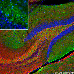 Immunofluorescent analysis of mouse hippocampus section stained with mouse mAb to &beta;-synuclein, MCA-6A10, dilution 1:500 in green, and costained with rabbit pAb to C-terminal peptide of rat NF-L, <a href="http://encorbio.com/product/rpca-nf-l-ct"  target="_blank" rel="noopener">RPCA-NF-L-ct</a>, dilution 1:5,000, in red. The blue is Hoechst staining of nuclear DNA. Following transcardial perfusion of mouse with 4% paraformaldehyde, brain was post fixed for 24 hours, cut to 45μM, and free-flo